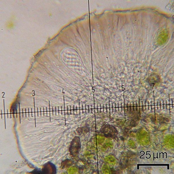 Scoliciosporum umbrinum