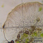 Scoliciosporum umbrinum