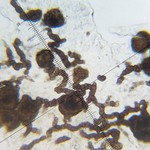 Sphaerellothecium abditum