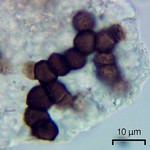 Sphaerellothecium abditum