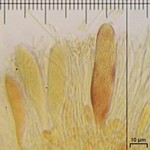 Spirographa fusisporella