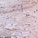 Stictis urceolatum