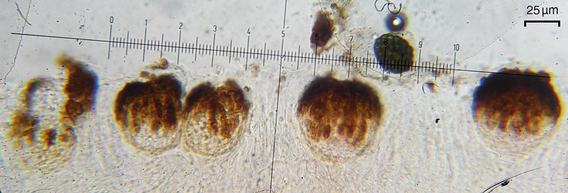 Stigmidium squamariae