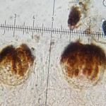 Stigmidium squamariae