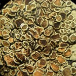 Stigmidium squamariae