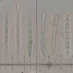 Toninia alutacea