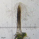 Tricharia santessonii