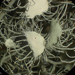 Usnea intermedia