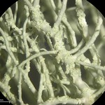 Usnea lapponica