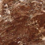Verrucaria dolosa
