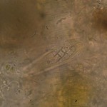 Vezdaea aestivalis